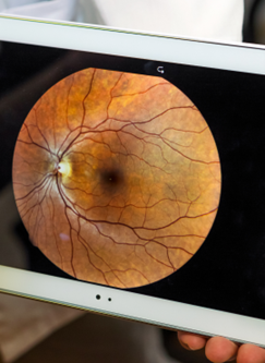 diagnóstico ocular en Opticalia Torredonjimeno